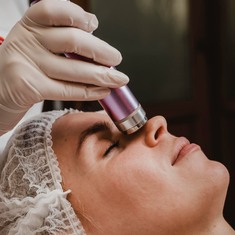 PICO Skin Treatment Islamabad