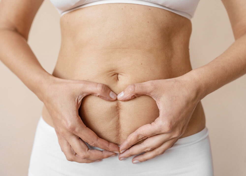 Post-Surgical Scar Treatment
