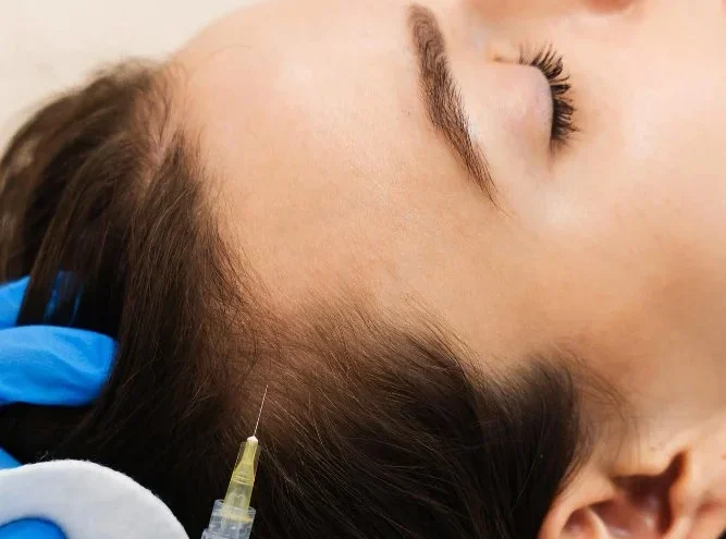 Best Mesotherapy treatment in Islamabad with cheap price at dermalase Clinic. Book your Consultation witrh Dr. Shumaila Khan.